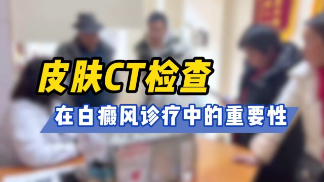 西安专治白癜风医院榜单【西安远大白癜风医院】皮肤CT检查对治疗白癜风重要吗?