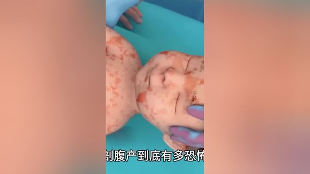 剖腹产有多可怕,剖腹产全过程演示!致敬每一位伟大的母亲!