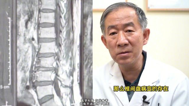 警惕腰椎病变:椎间隙变窄可能是椎间盘退变的信号