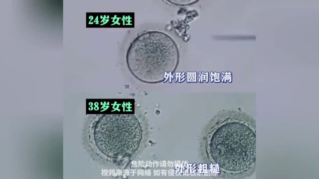 24岁和38岁女性显微镜下的卵子对比