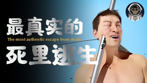 男子被铁棒刺穿头部，竟能奇迹般的死里逃生！_高清1080P在线观看平台_腾讯视频
