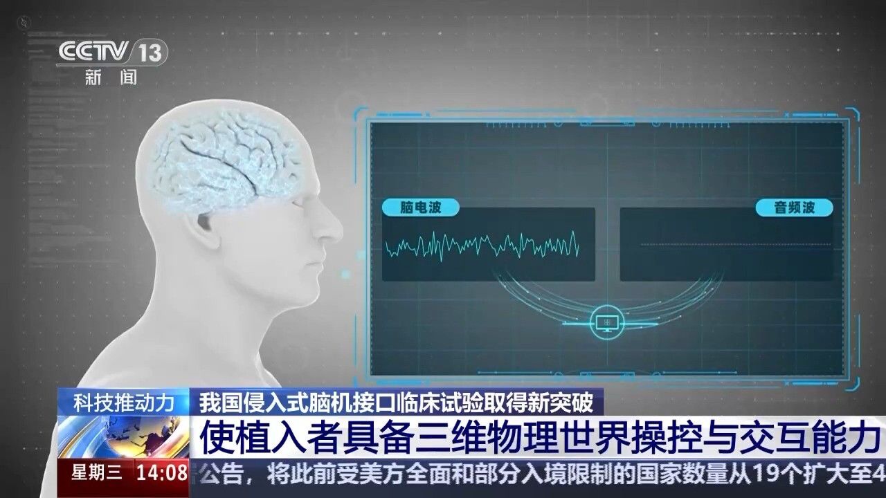 视频丨新突破！我国侵入式脑机接口临床试验实现三维物理世界操控与交互_高清