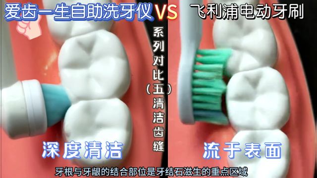 告别蛀牙、出血、发炎——全新概念产品自助洗牙仪