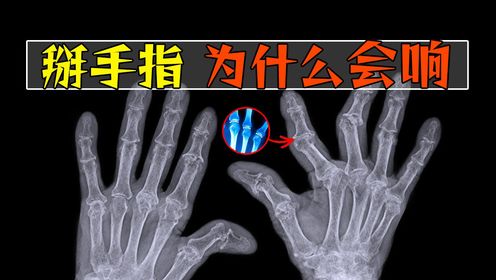掰手指为什么会咔咔响?对关节有没有什么坏处?_高清1080P在线观看平台_腾讯视频