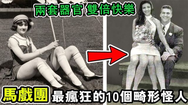 马戏团最疯狂10个畸形人,有两套身体器官的女性,第一名命运太惨