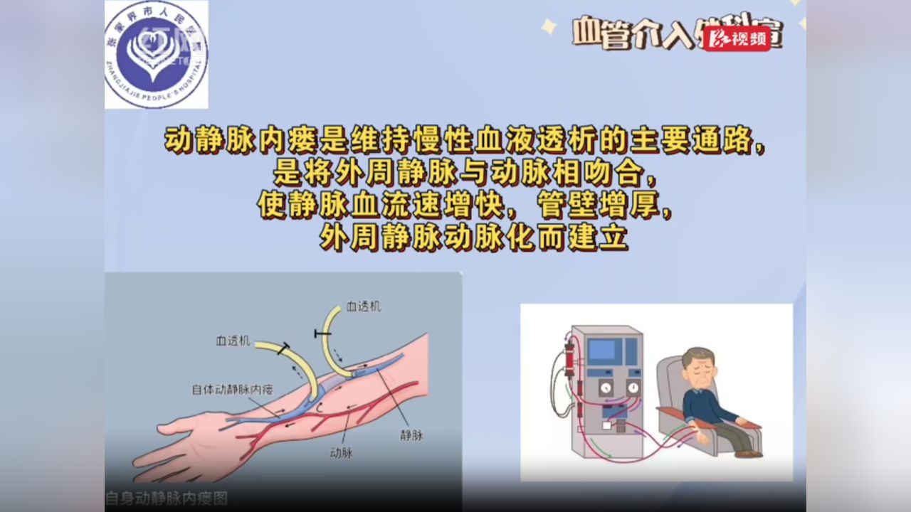 科普小知识｜保护动静脉内瘘_高清1080P在线观看平台_腾讯视频