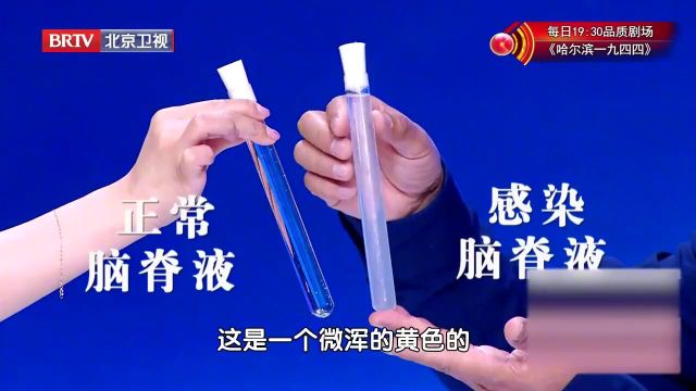 腰椎穿刺怎么做?为什么可以发现大脑的感染?什么时候需要做?