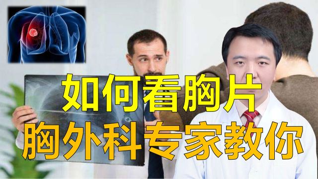 胸片可以发现肺癌、肺结节,如何看?胸外科专家亲自教你