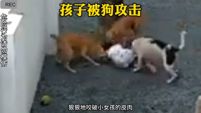 狗咬小孩