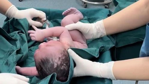 刚出生的宝宝一动不敢动：护士阿姨请轻点，我刚出生我害怕！