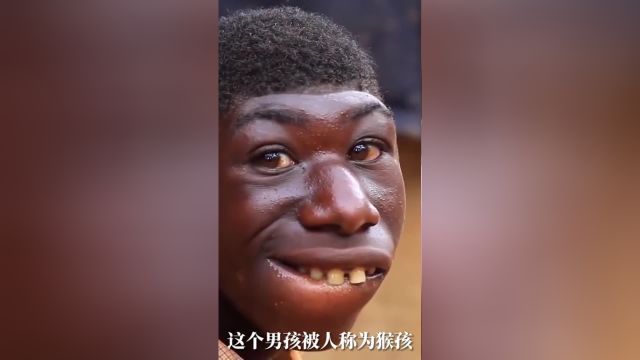 奇特的猴脸男孩,让我们一探究竟!##1