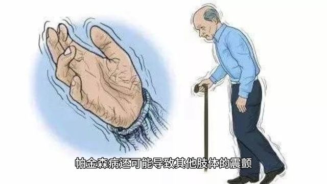 从生理到心理:全面解析震颤产生的各种原因