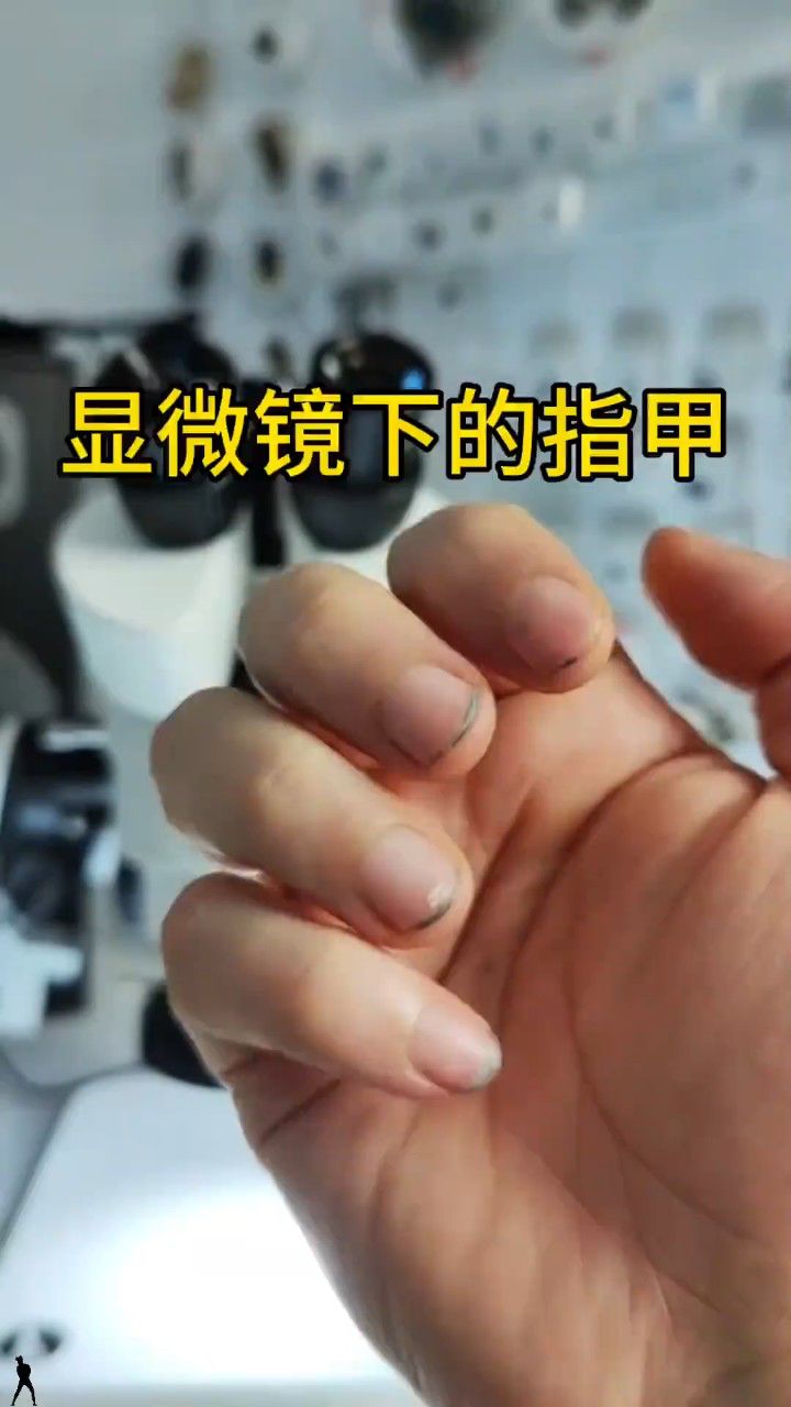 显微镜下的指甲到底是谁在跳科目三