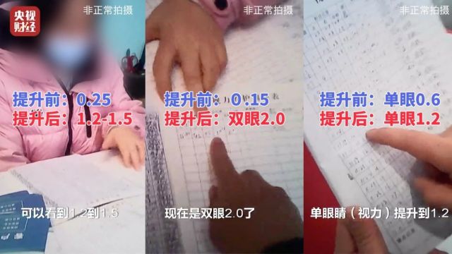 7天摘掉近视镜?央视记者“含泪”体验