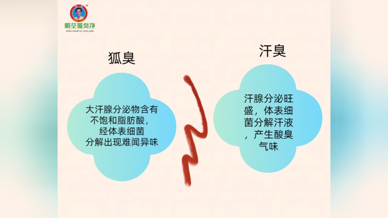 狐臭是由于大汗腺肌上皮细胞间隙异常,分泌旺盛,分泌物中含有大量的