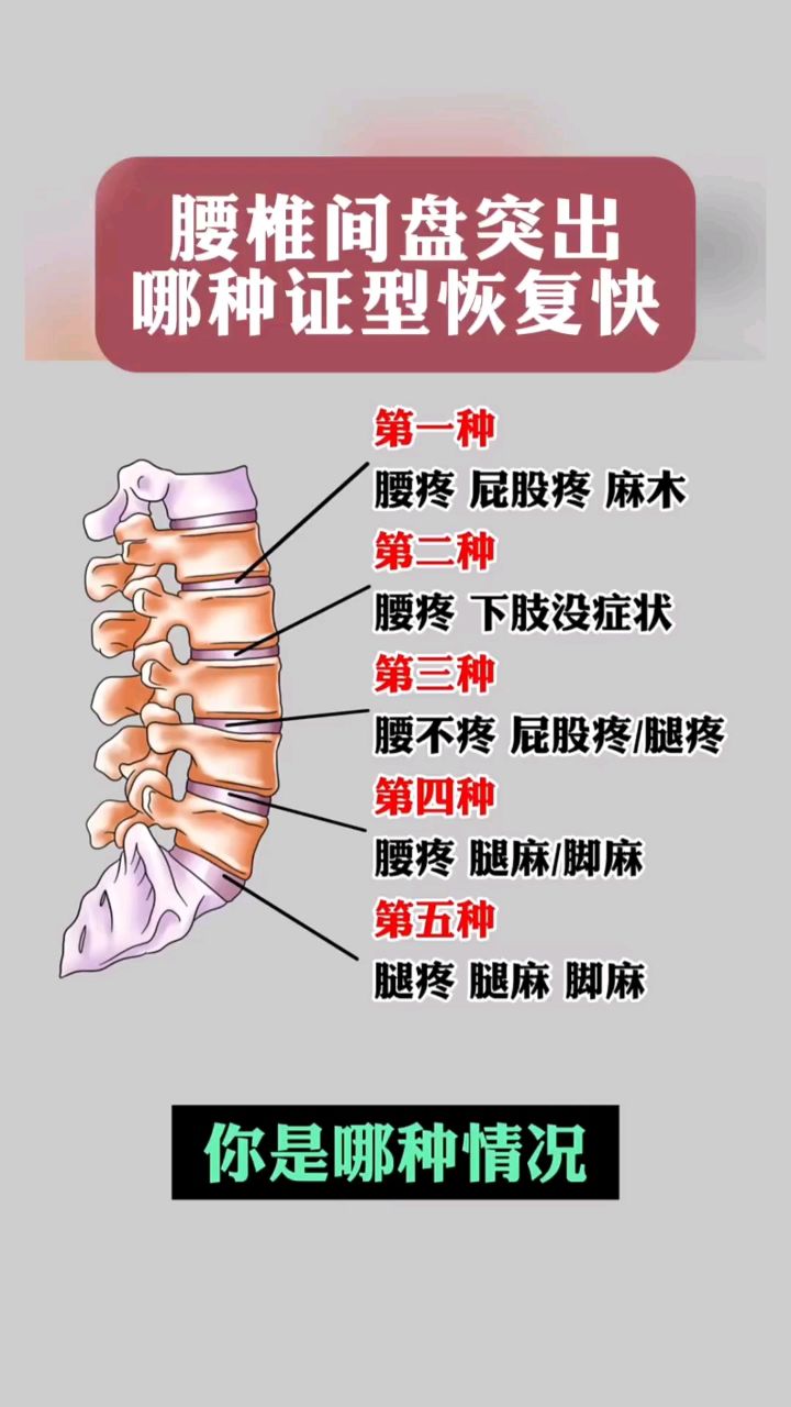 附桂骨痛腰椎间盘突出图片