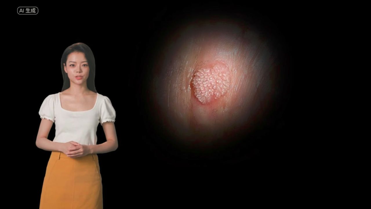 菜花状疣图片男性-南京圣贝医院