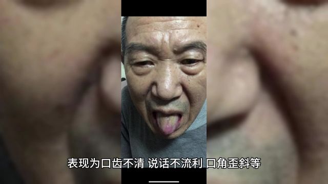 张雪中风的前兆有什么症状