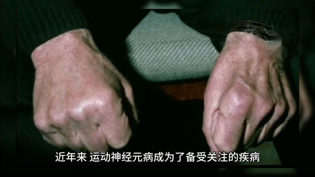 近年来,运动神经元病成为了一个备受关注的疾病.这类疾病是一种进展性的神经系统退化性疾病,会影响人体的运动功能,给患者的生活带来诸