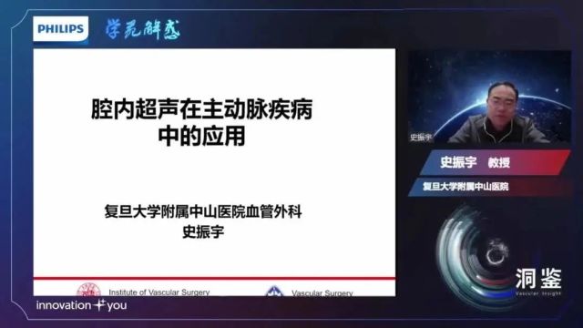 【洞鉴ⷥ�‹‘解惑】史振宇教授|「IVUS读图系列课程」第四期:腔内超声在主动脉疾病中的应用