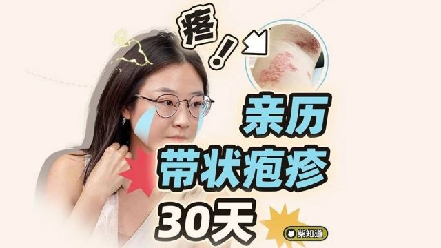 埋在每个人身上的雷,在我这爆发了:带状疱疹血泪科普| 图文