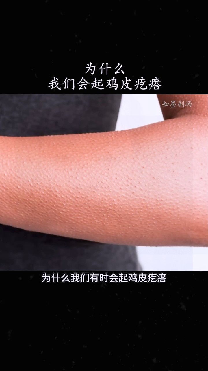 为什么我们会起鸡皮疙瘩解释