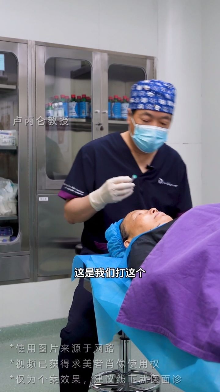 液态提升——颈阔肌注射肉毒素实操