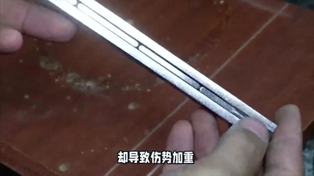 男子用磁铁吸扎腿铁屑,伤上加伤,网友:听着就肉疼