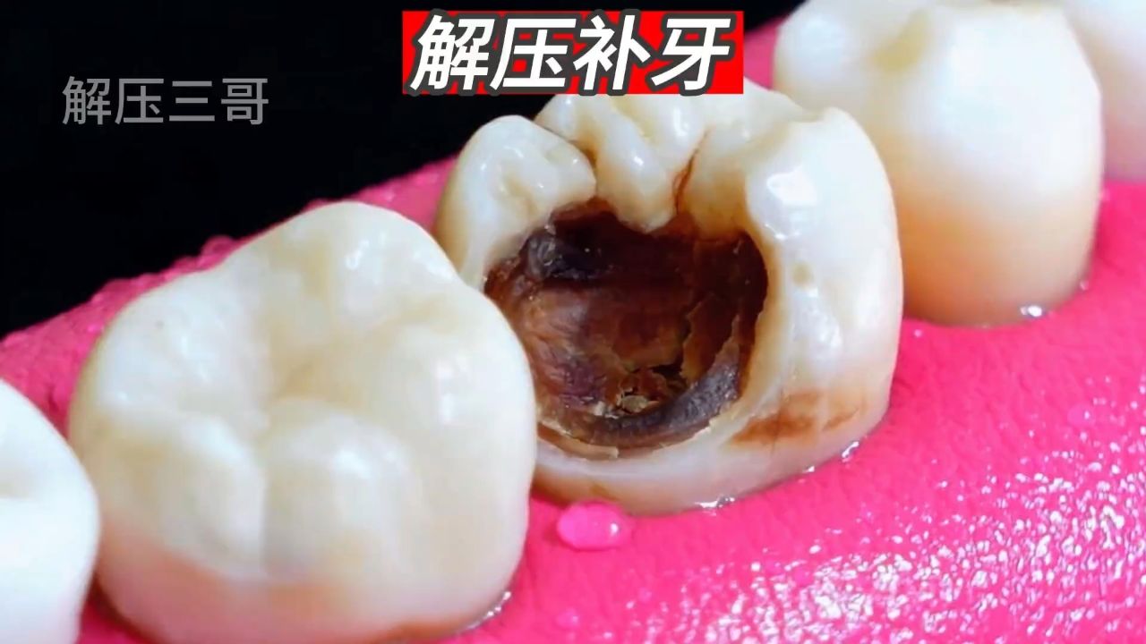 牙齿烂了个大洞该怎么办?