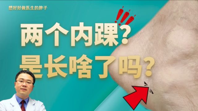 鲜为人知的常见疾病:副舟骨综合征!特点:看起来长了两个内踝!