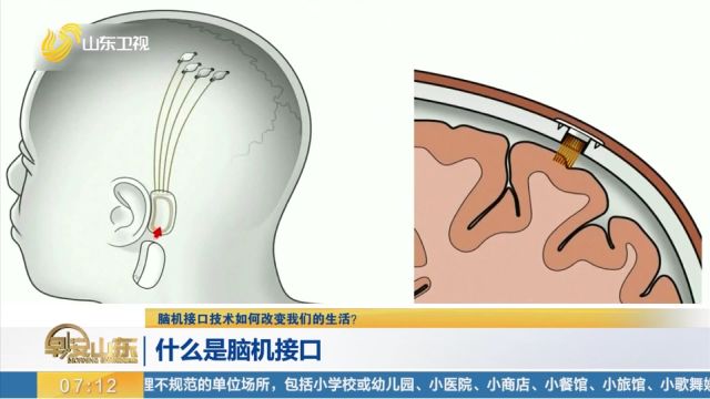 什么是脑机接口,这项技术会如何影响和改变我们的生活?来看看