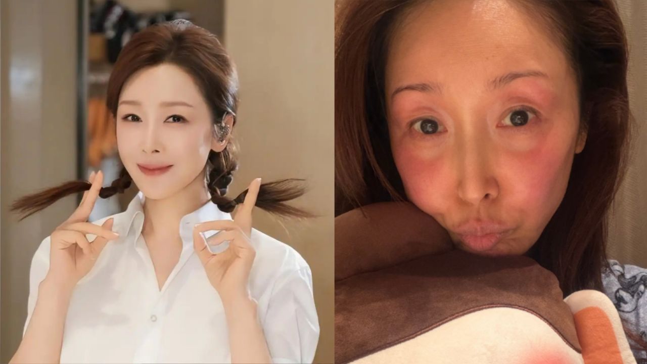 知名女星孙悦录春晚被冻伤,脸部通红引网友心疼,当天零下20度_高清1080P在线观看平台_腾讯视频