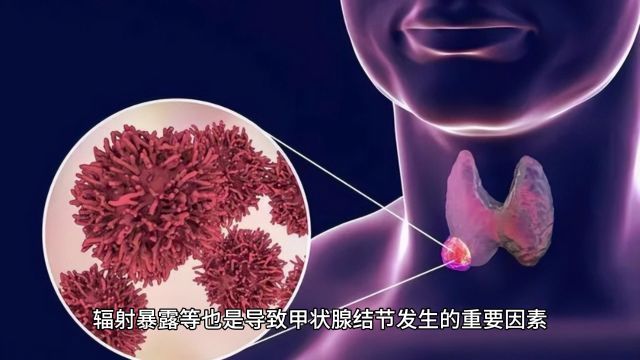 芦殿荣甲状腺结节是什么病