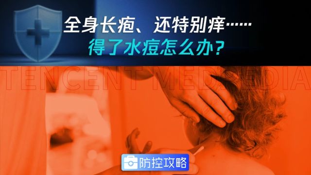 全身长疱、还特别痒……得了水痘怎么办?