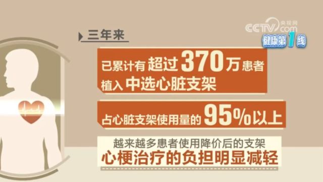 超370万人植入集采心脏支架,费用负担减轻