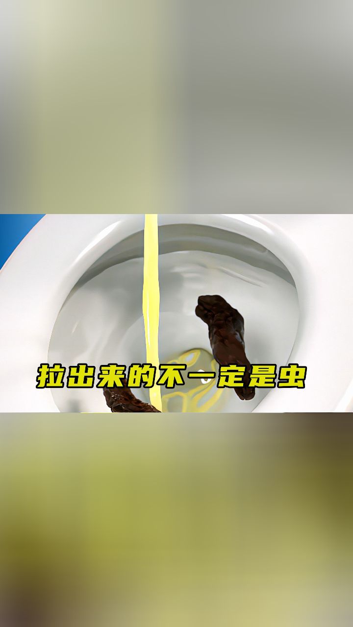 人蛔虫拉屎图片