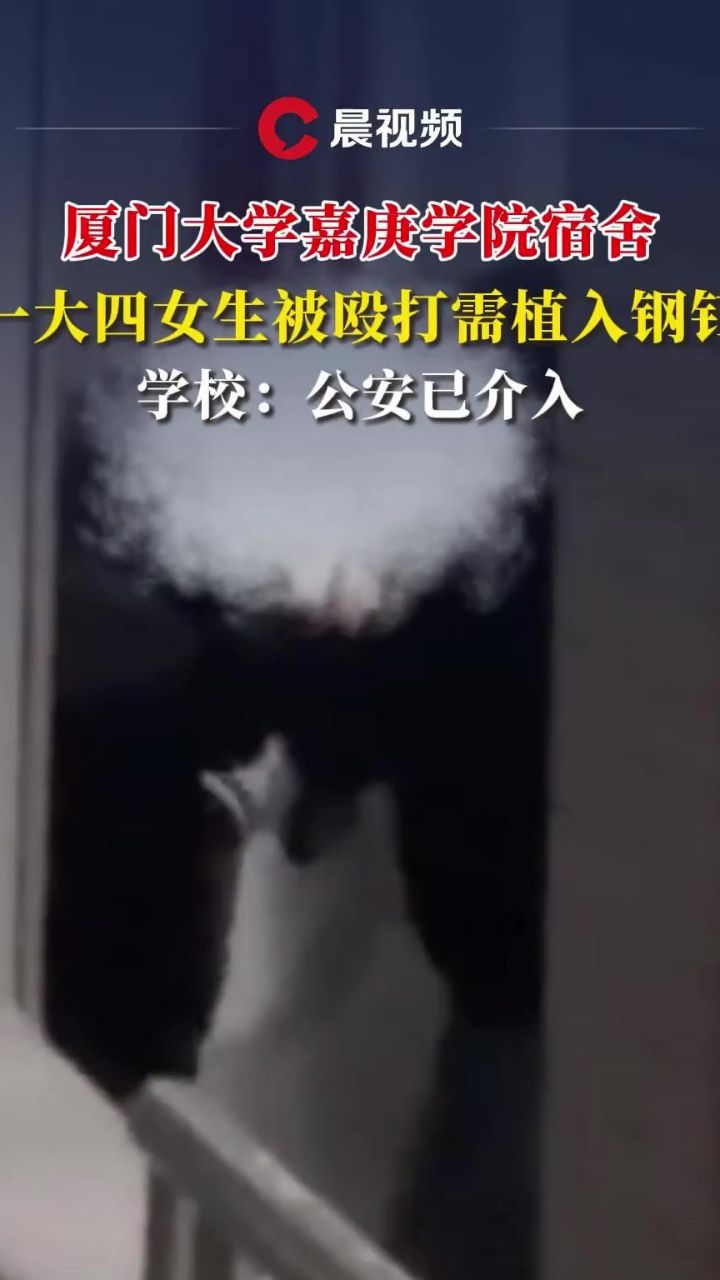 厦门大学嘉庚学院一女生被殴打需植入钢钉,坐轮椅,并有瘫痪风险,学校