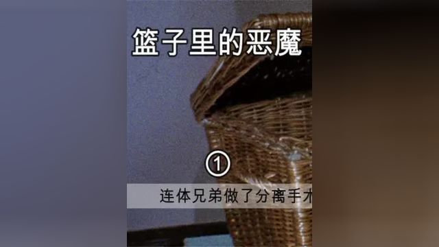 连体兄弟做了分离手术,弟弟变成一只怪物 #篮子里的恶魔 #恐怖 #电影解说