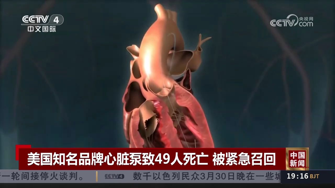 美国知名品牌心脏泵致49人死亡 被紧急召回