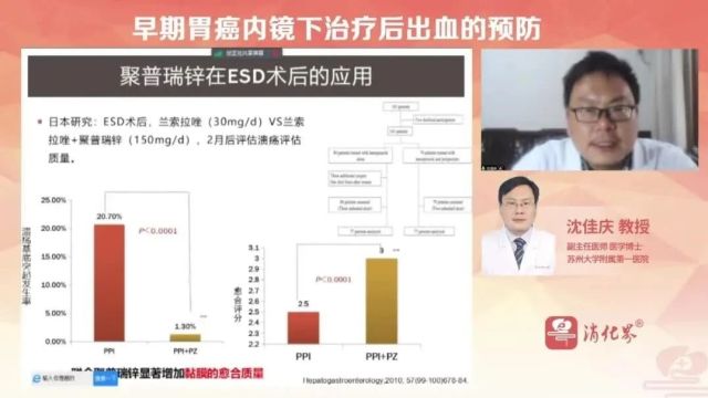 沈佳庆教授:早期胃癌内镜下治疗后出血的预防