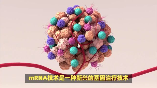 mRNA技术或将成为实体肿瘤综合治疗的核心武器