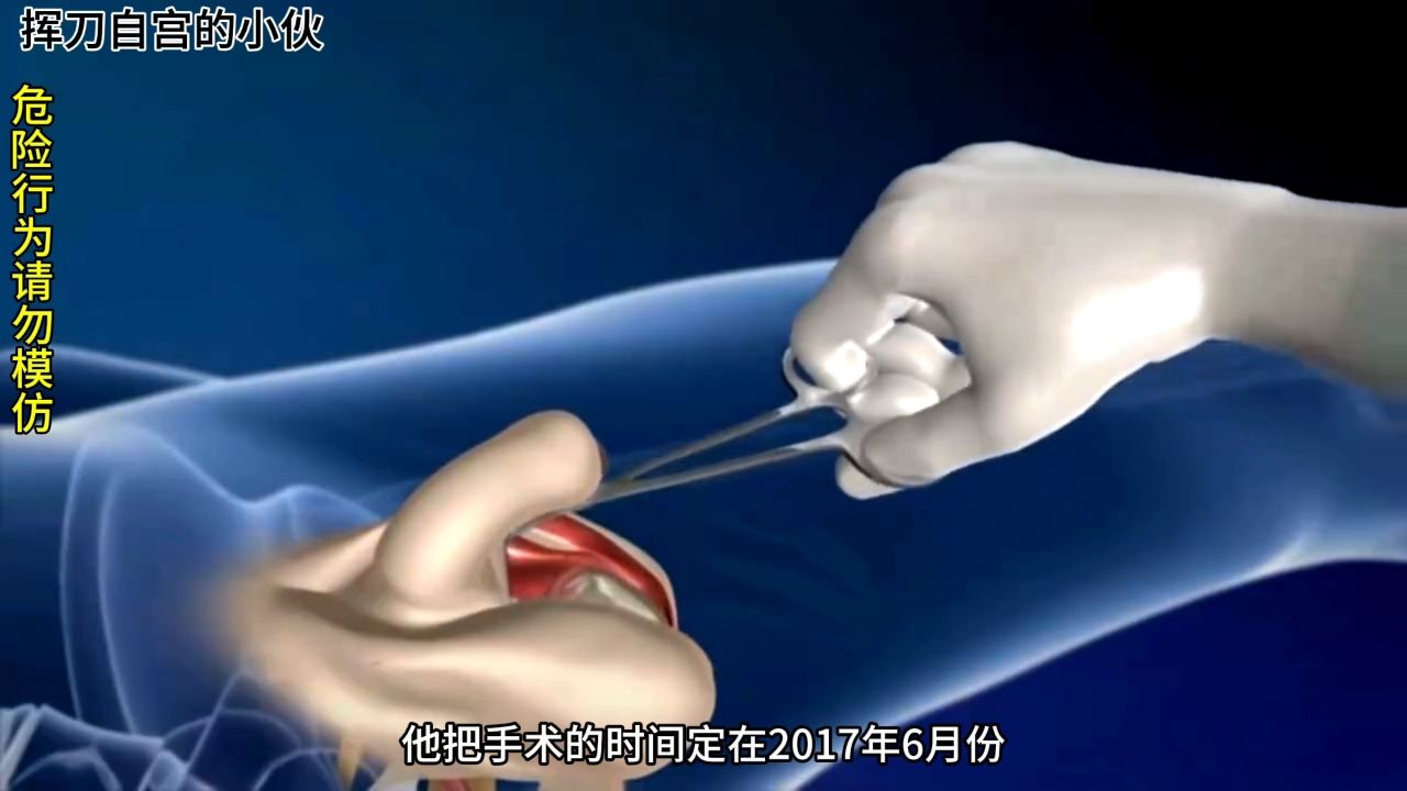 男子网上自学自宫