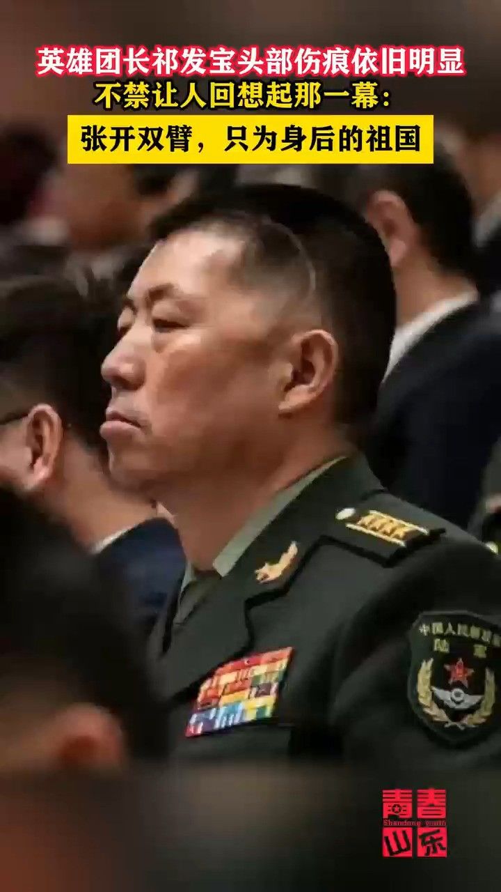 英雄团长祁发宝头部伤痕依旧明显,不禁让人回想起那一幕:张开双臂,只