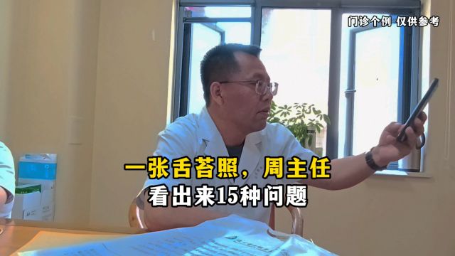 一张舌苔照,周主任看出来15种问题,周永强主任看病怎么样?看完这个视频你就明白了