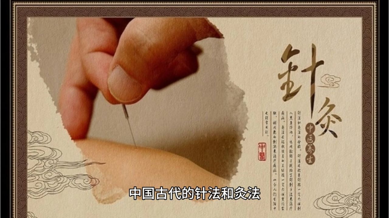 针灸-中医治疗