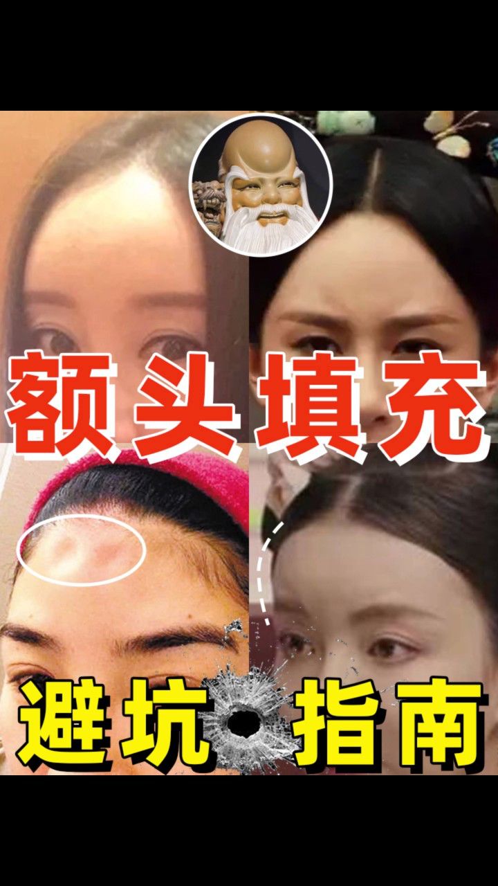 额头洋气又自然,拒绝寿星公!