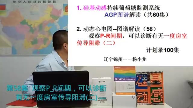 第58集观察PR间期,可以诊断有无一度房室传导阻滞(二)