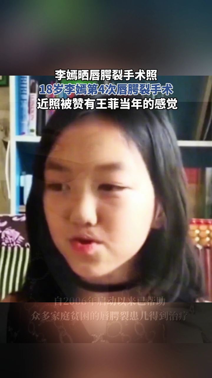 李嫣晒唇腭裂手术照,18岁李嫣第4次唇腭裂手术 近照被赞有王菲当年的