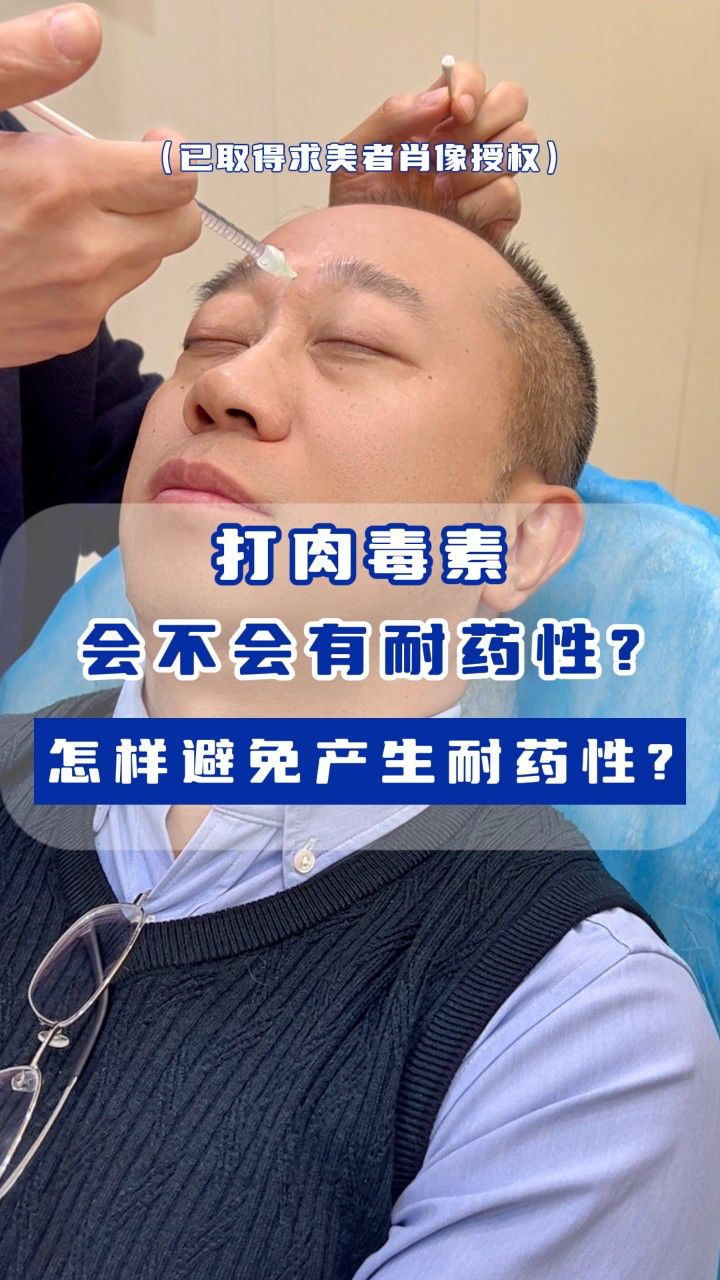 打肉毒素会不会有耐药性,怎样避免产生耐药性?