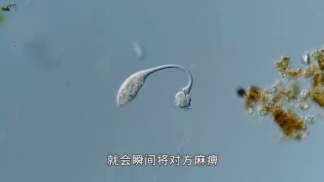 大开眼界的微生物世界二